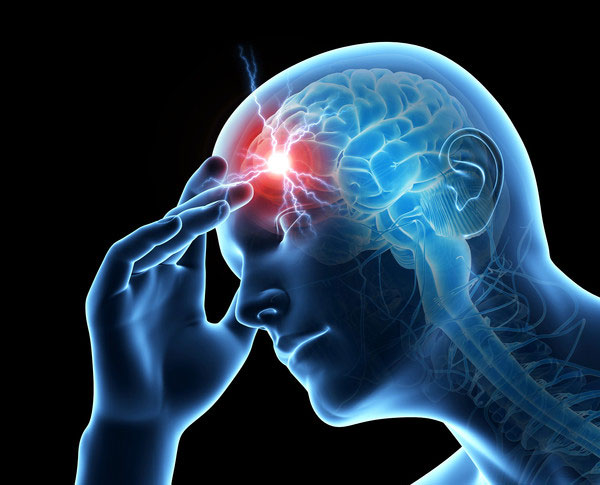Marijuana helps patients with Migraine headaches