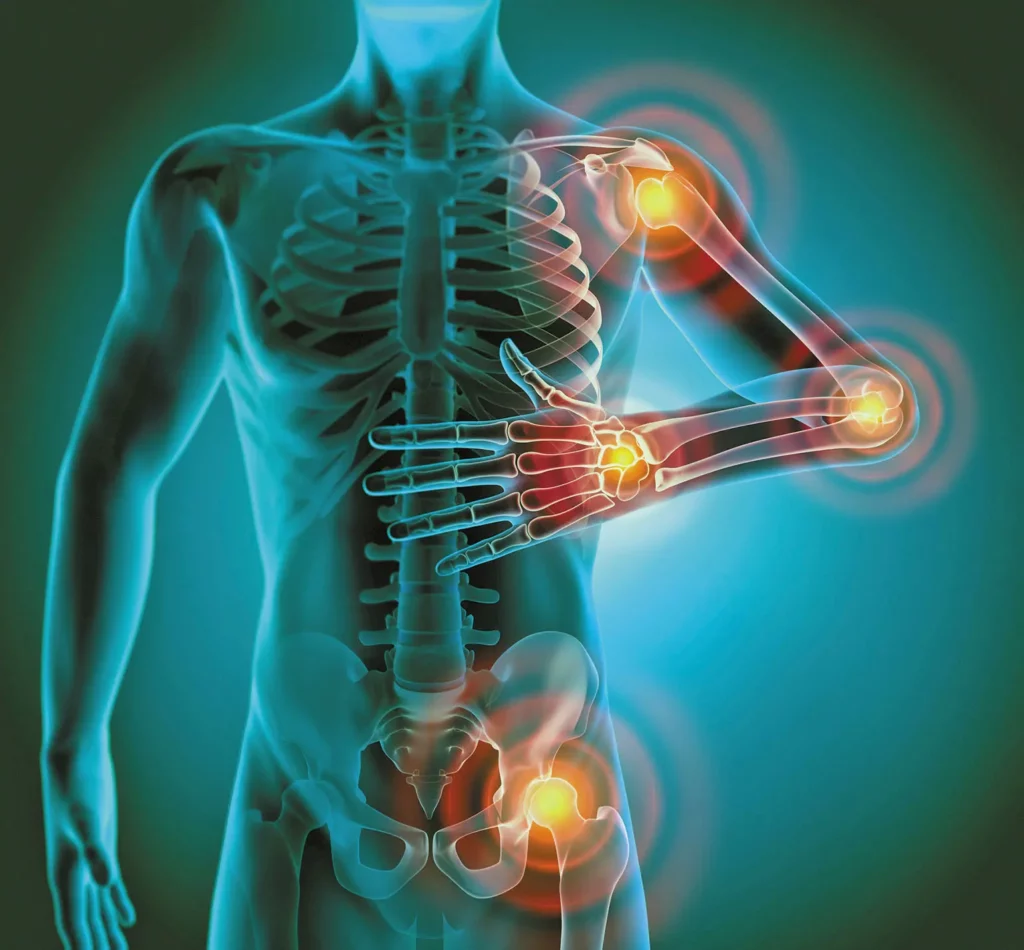 Chronic inflammation causes pain and disease