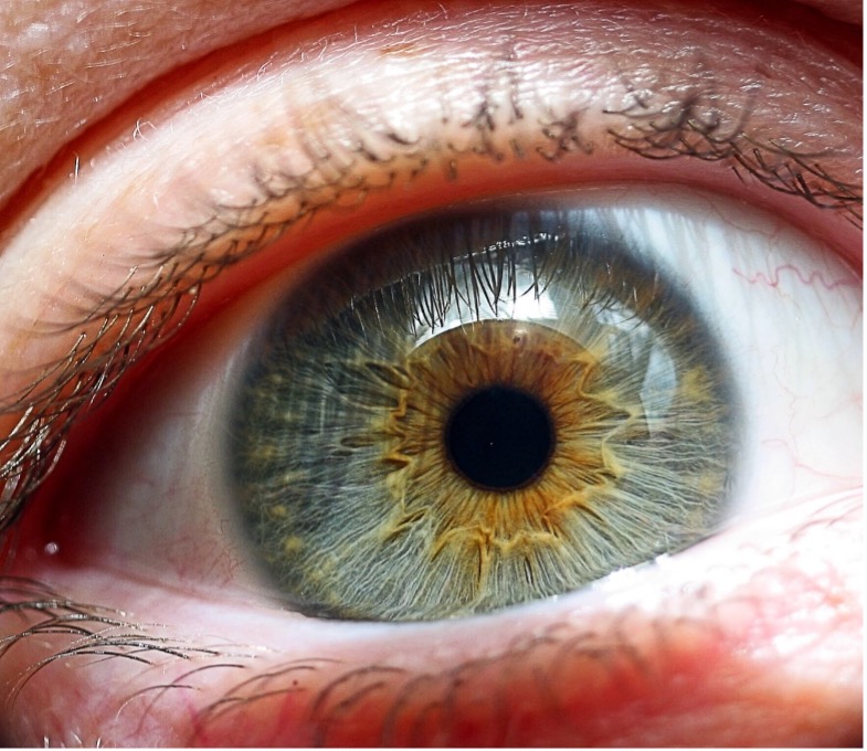 glaucoma-and-cannabis