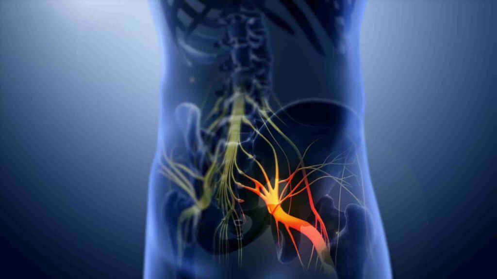 sciatica-pain-may-be relieved-with-medical-cannabis