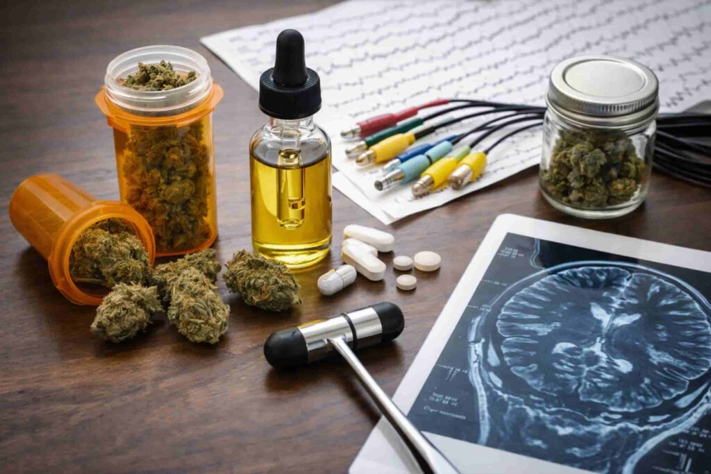 Medical marijuana flower and CBD oil displayed with EEG leads and brain MRI, illustrating medical cannabis treatment for neurologic conditions