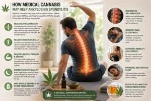 Medical infographic illustrating how medical cannabis may help ankylosing spondylitis by reducing inflammation, relieving pain and stiffness, improving sleep, and supporting mobility.